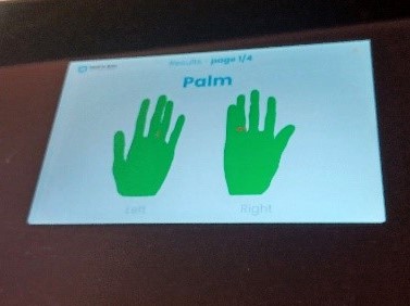 Un écran affiche les contours verts d'une main gauche et d'une main droite étiquetées Left et Right avec le mot Palm au-dessus d'elles et un petit point rouge sur la main droite.